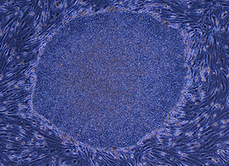 再生医療や創薬への応用が期待されるiPS細胞
